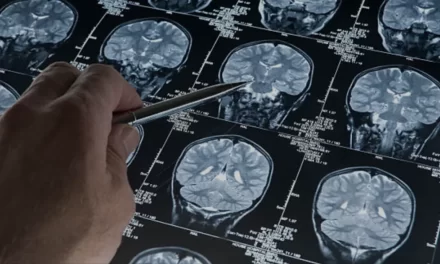 Nuove Frontiere della Comprensione del Cervello