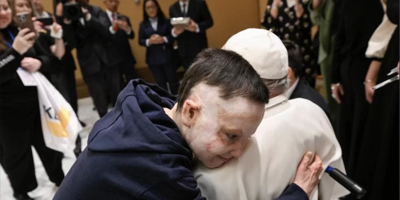 L’orrore della guerra nell’abbraccio al Papa di un bambino sfigurato dalle bombe