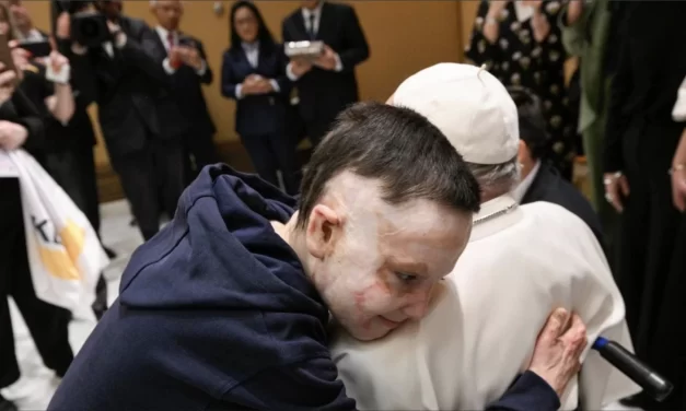L’orrore della guerra nell’abbraccio al Papa di un bambino sfigurato dalle bombe